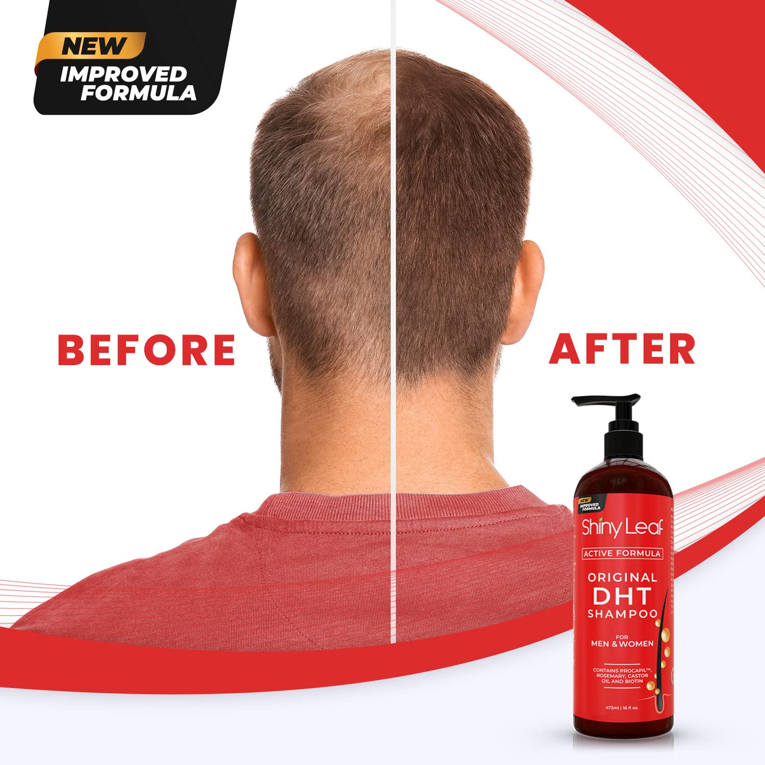 DHT Blocker Hair Loss Shampoo with Biotin Active Growth Formula