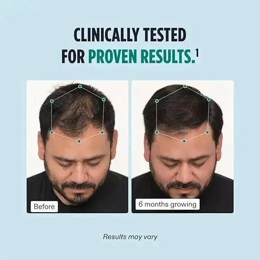 Men Balance Hair Growth Supplement